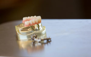 Model of all-on-4 dental implants