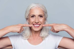 dental patient smiling after all-on-4 dental implants