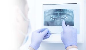 oral surgeon examining an x-ray
