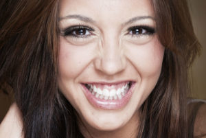 a dental patient in need of gummy smile treatment