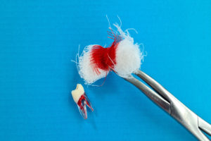 A Wisdom Tooth After Being Extracted