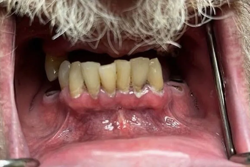 BEFORE