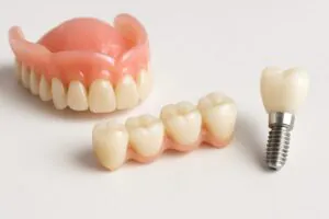 Close-up image showcasing various fake teeth replacement options, including dentures, bridges, and implants, arranged aesthetically on a clean, white dental surface. No text on the image.