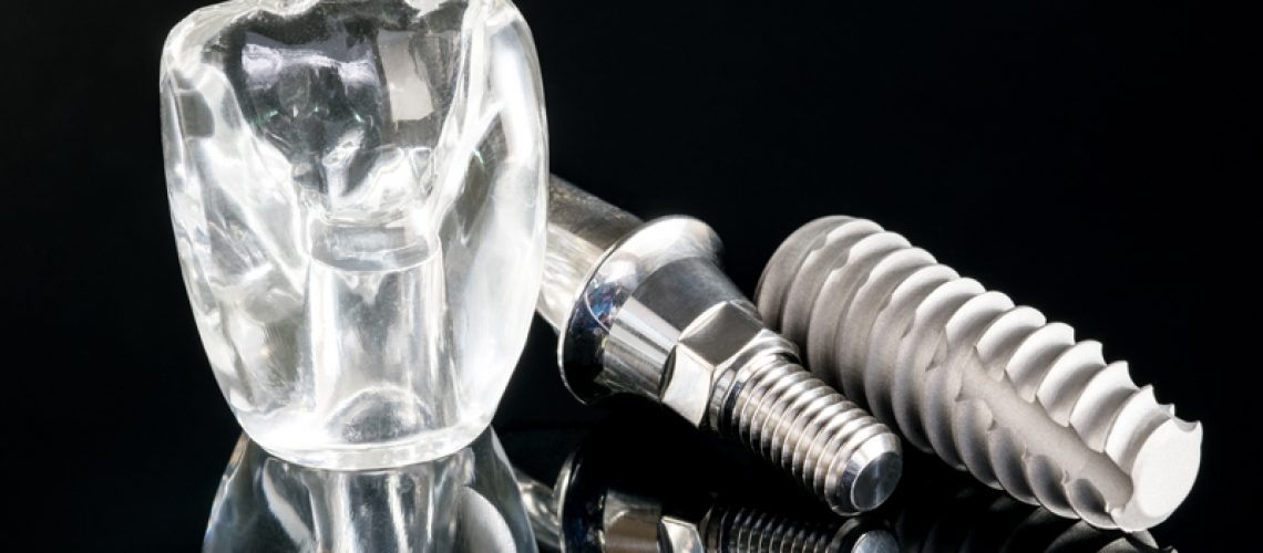 Close-up dental implant model on a black glass table and background.