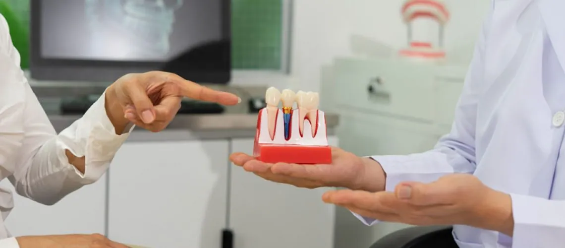 Dentist explains dental implants using model in dental clinic.