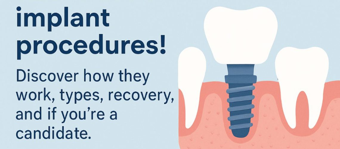 Image of a dentist explaining implant procedures to a patient with a digital x-ray displayed on a screen. The image should be in a modern dental office setting, conveying professionalism and trust. No text on the image.