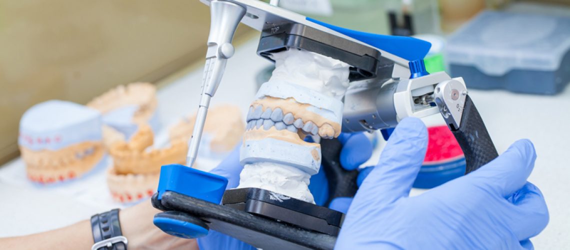 Photo of a doctor holding a pair of jaw prosesthis implants
