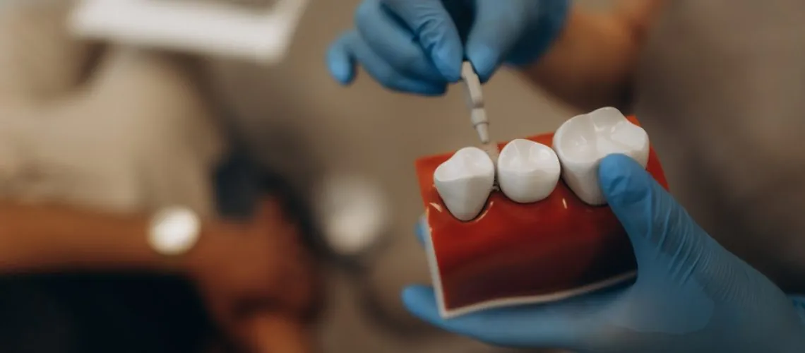 Dentist,Explaining,The,Dental,Implant,Procedure,While,Using,A,Detailed
